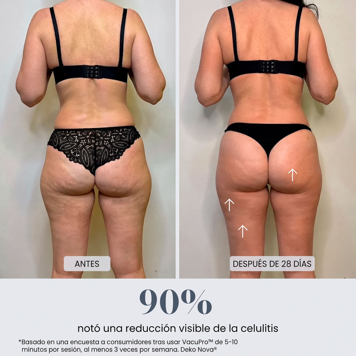 VacuPro™ Masajeador Anticelulítico de Ventosa y Calor