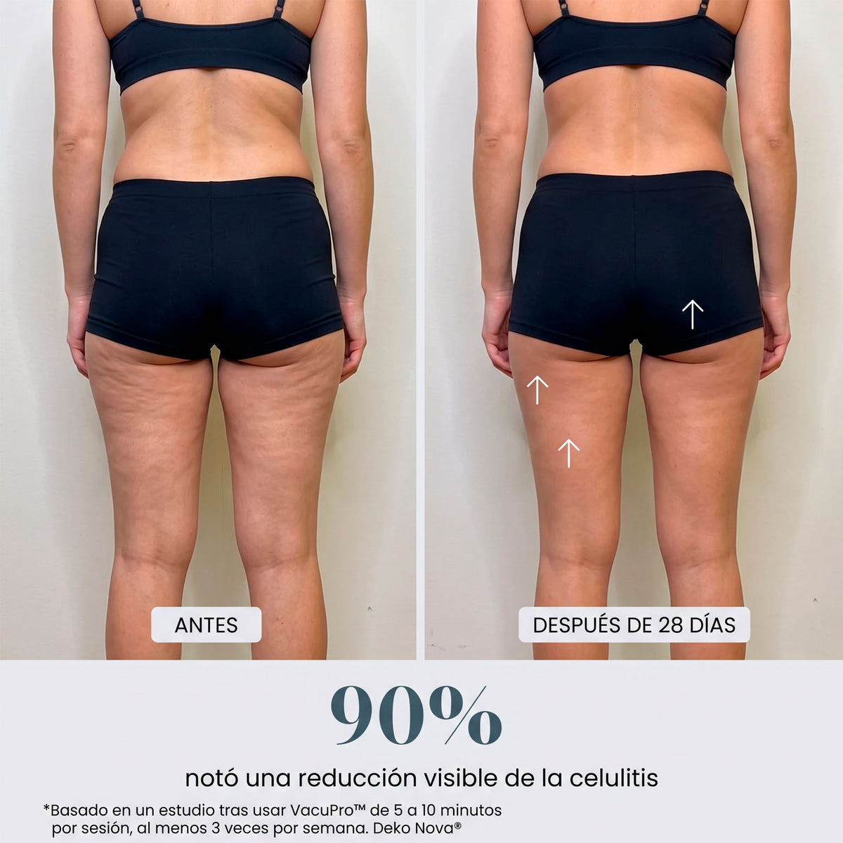 VacuPro™ Masajeador Anticelulítico de Ventosa y Calor
