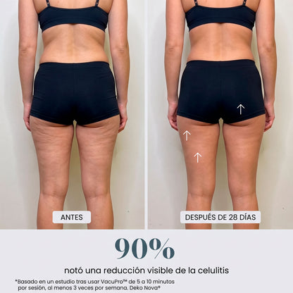 VacuPro™ Masajeador Anticelulítico de Ventosa y Calor
