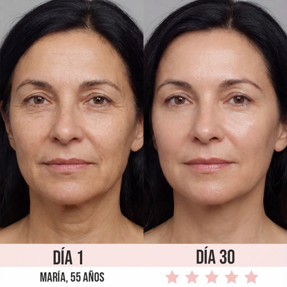 NovaLift Pro™ Rejuvenecimiento Facial 7 en 1