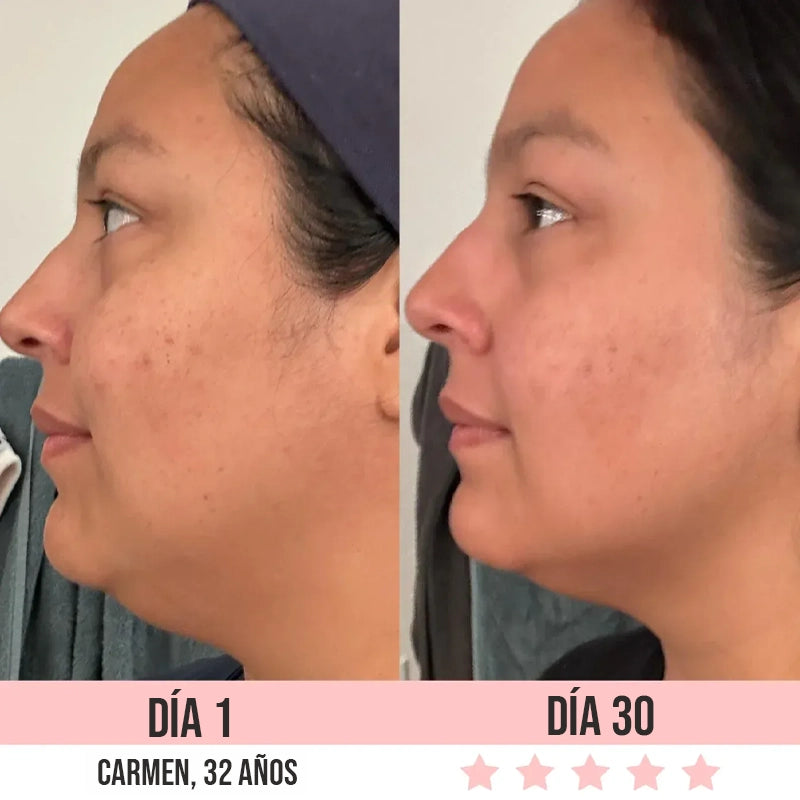 NovaLift Pro™ Rejuvenecimiento Facial 7 en 1